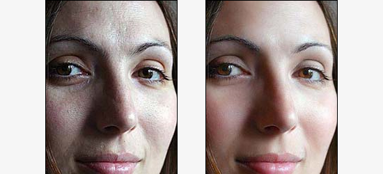 Эффект улучшения кожи